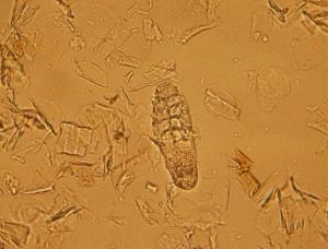 Think like a dermatologist: untangling itch