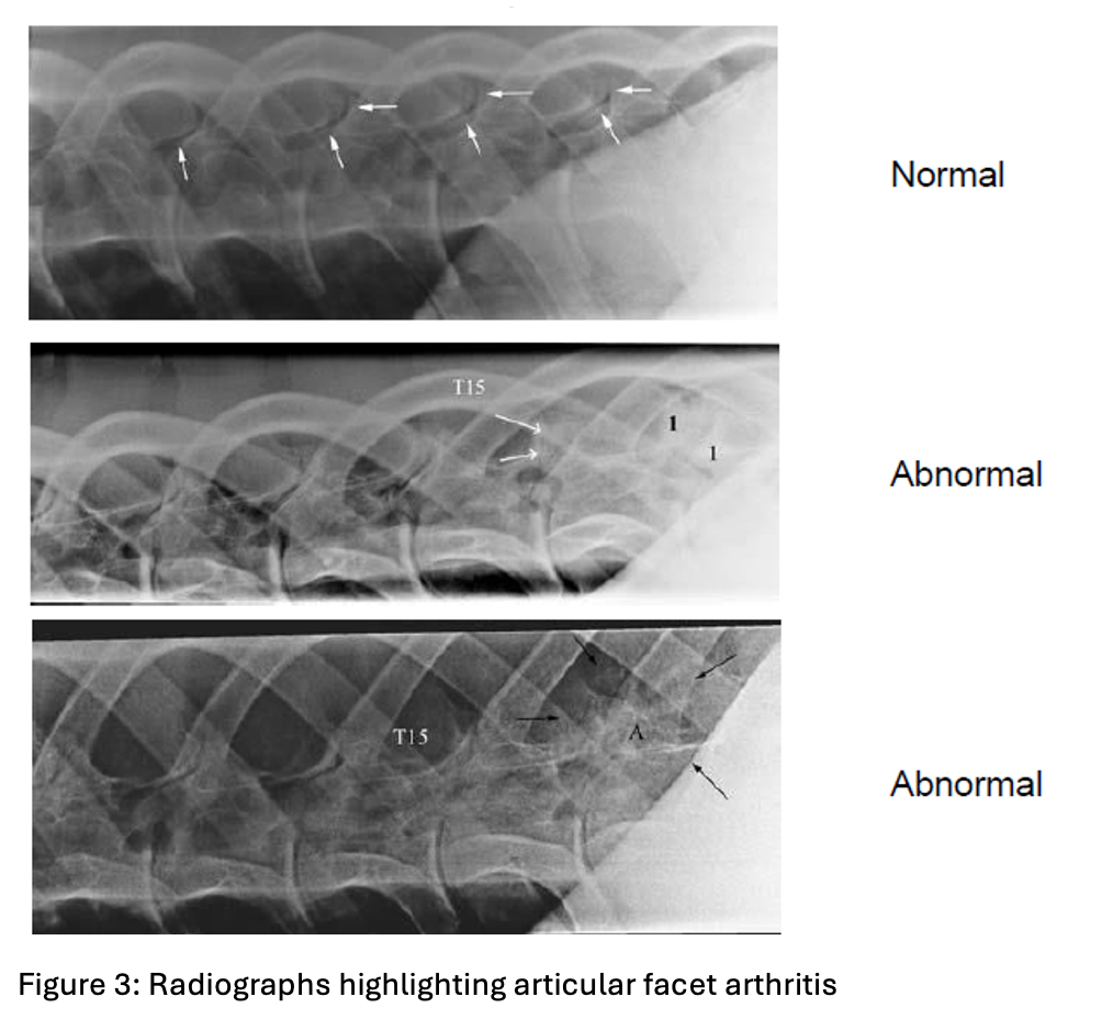 Radiographs highlighting articular facet arthritis