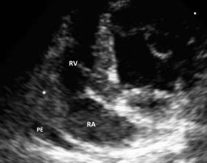 Cardiac tumors in dogs and cats