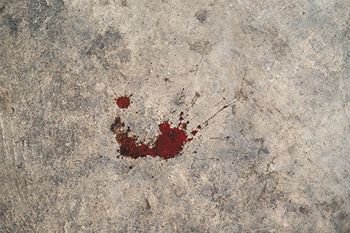veterinary-blood-drops-on-the-cement-floor-450px-shutterstock-710189977.jpg