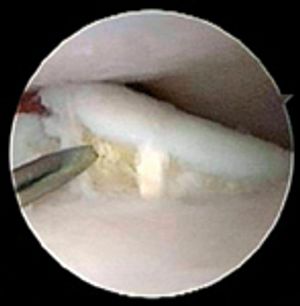 veterinary0710_elbow_Fig2-676592-1384277478683.jpg