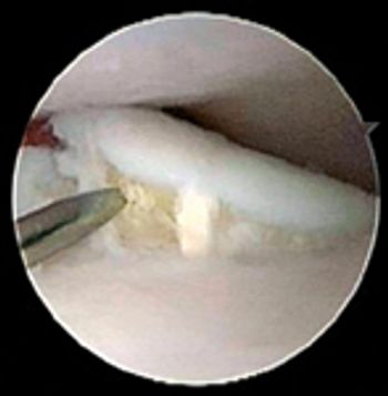 veterinary0710_elbow_Fig2-676592-1384277478683.jpg