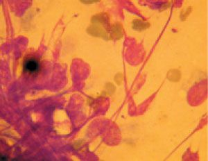 CytologySlideShow-523805-1384676471418.jpg