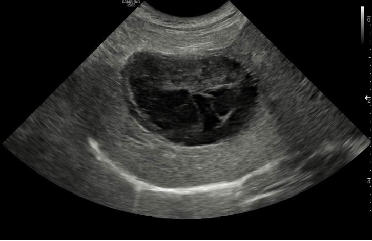 Gallbladder mucoceles in dogs: Diagnosis, surgical management, and postoperative care
