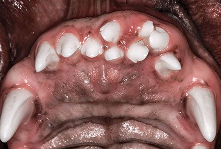 The ABCs of veterinary dentistry: S is for supernumerary teeth
