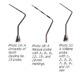 Dental Probes And Explorers Musts For Examination