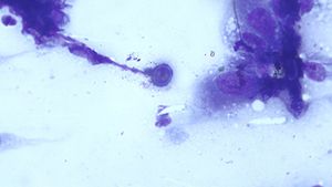 Cytology_Bello_ImageQuiz_image-body.jpg