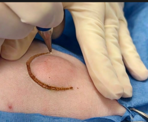 Advanced laser surgery, and digital cytology elevate pet care