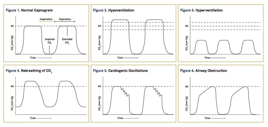 Avma 17 Anesthesia Monitoring With Capnography Avma 17 Anesthesia Monitoring With Capnography