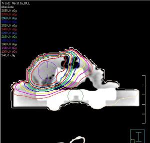 Clinical case study: Radiation therapy for facial mast cell tumor in a beagle