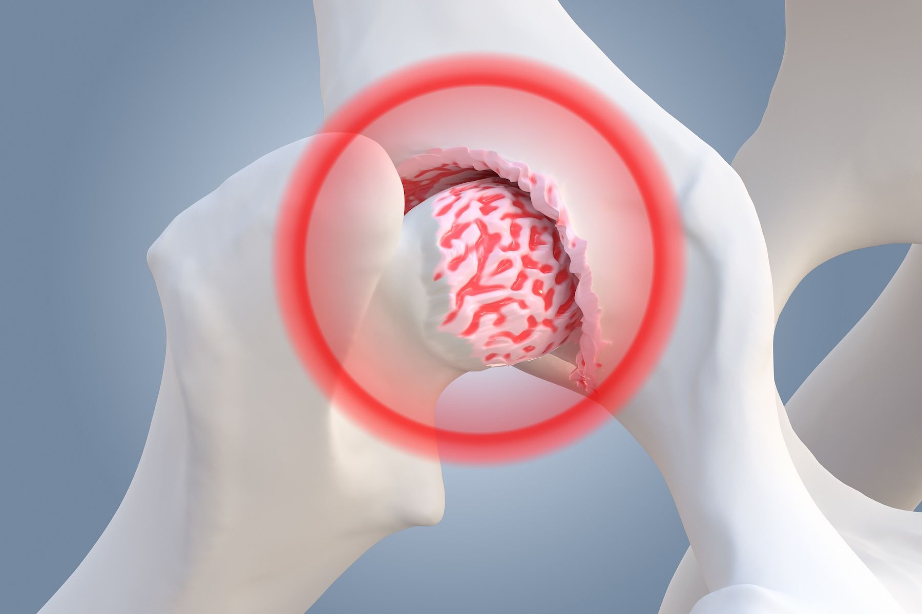 Canine osteoarthritis