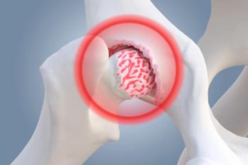 canine osteoarthritis