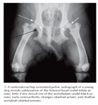 2-xRay-569656-1384531972067.jpg