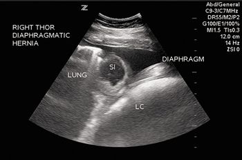 veterinary_Kane_Figure2_Diaphragmatichernia_460px.jpg