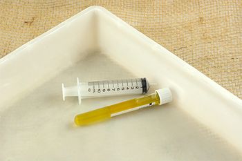 veterinary-urine-sample-AdobeStock_123592166-main.jpeg.jpg