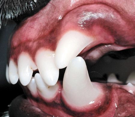 Fix the fixable: Treating periodontal and orthodontic disease