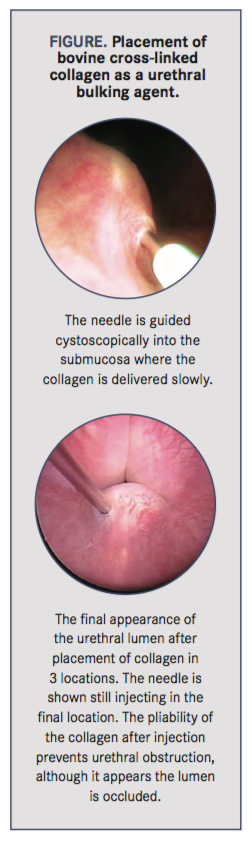 Canine Urinary Incontinence