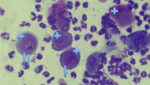 cytology-with-arrows_450.jpg