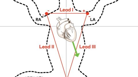 Reading Ecgs In Veterinary Patients An Introduction Reading Ecgs In Veterinary Patients An Introduction