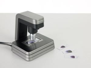 Why a blood smear evaluation should be performed with every CBC