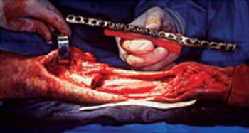 Jan-ACVS-Photo 1_allograft_Seguin_rev-574380-1384525776274.jpg