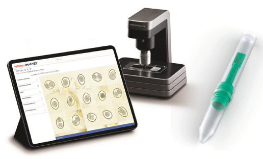 Fecal testing made easy, fast, clean, and accurate