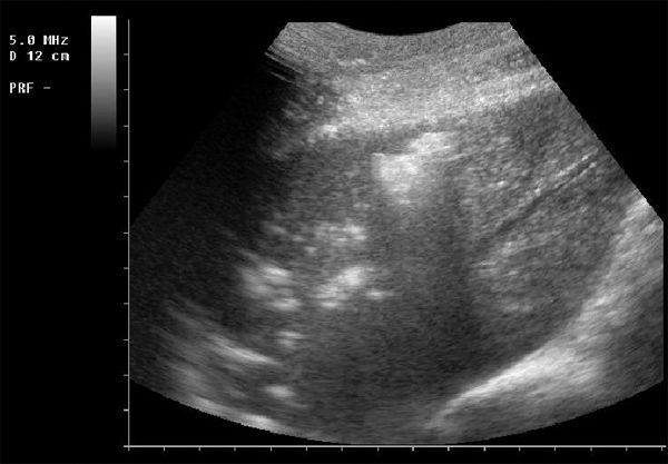 Respiratory Disease In Weanlings (proceedings)