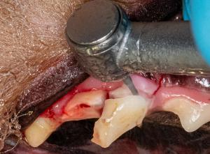 Toothaches and triumphs