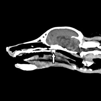 Head_CT_Sagittal_JPEG_Circle-450.jpg