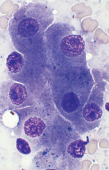 circumanal_figure_2B_200-667499-1384322812190.jpg