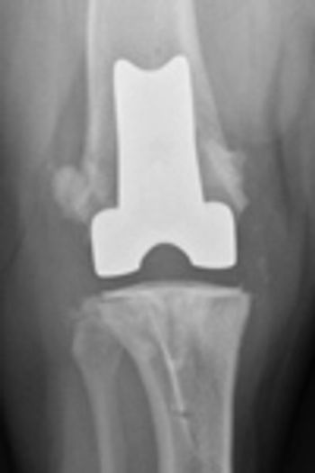 dvm0410_SurgSTAT_Fig4-662429-1384322196882.jpg