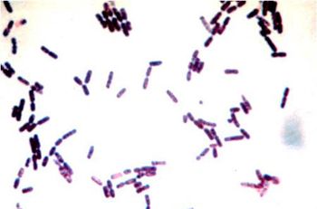 rod_organisms_450-751155-1384173008107.jpg