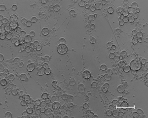  Microscopic image of equine herpesvirus (EHV-1).
