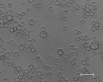  Microscopic image of equine herpesvirus (EHV-1).