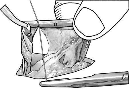 How to perform an ovariectomy