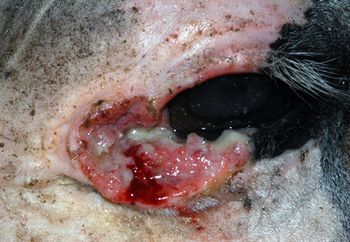 LR-Advanced-SCC-of-medial-canthus-eyelid.jpg