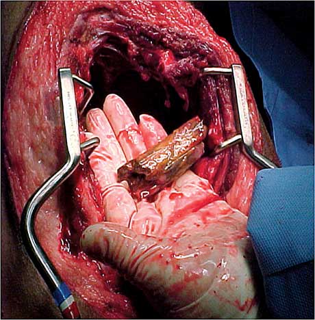 veterinary_crowe_case_2-615016-1384500583231.jpg