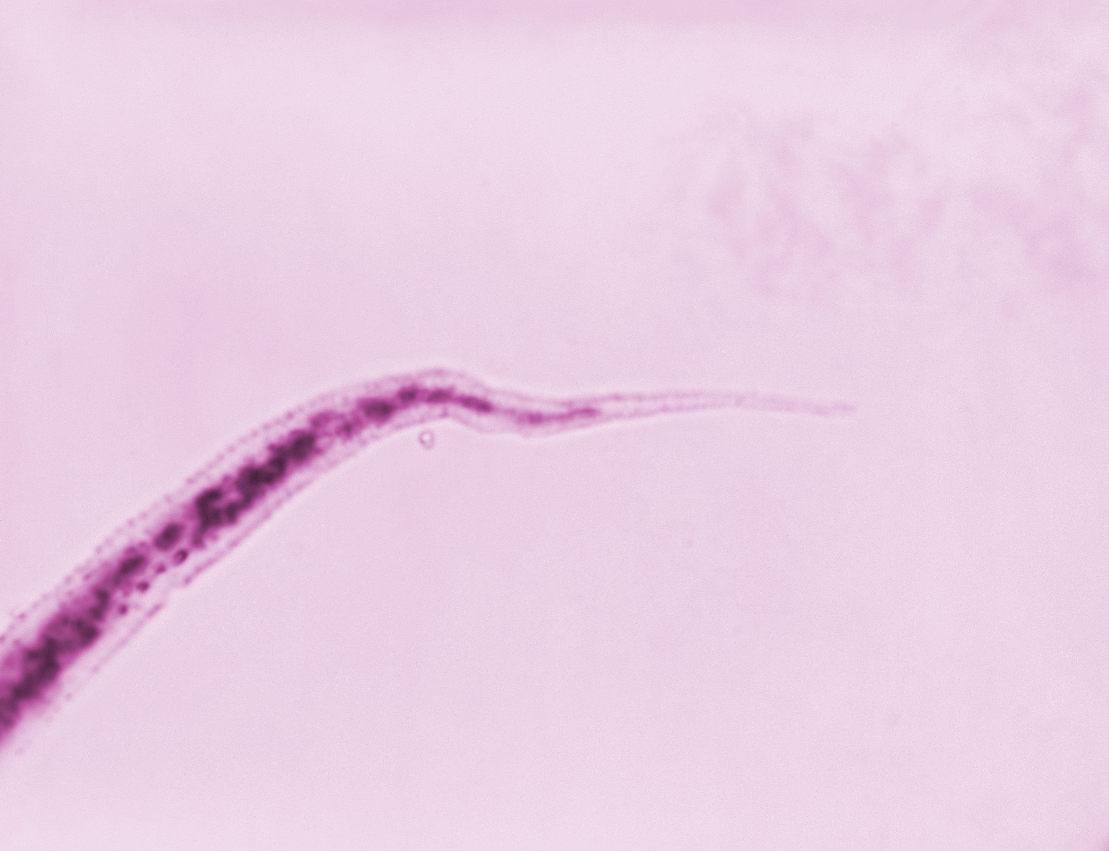 1003127 heart-worm | PPT, image size:3548x2724