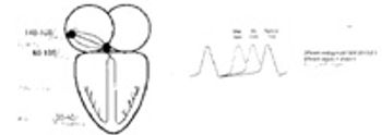 diagram2_t-565759-1384605028955.jpg
