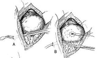 Figure1-587148-1384515903200.jpg
