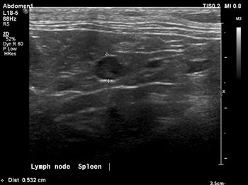 Clinical_Rounds_feline_MCT_Figure-8_450.jpg