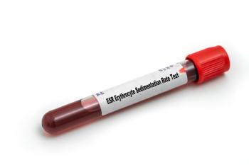 erythrocyte sedimentation rate test