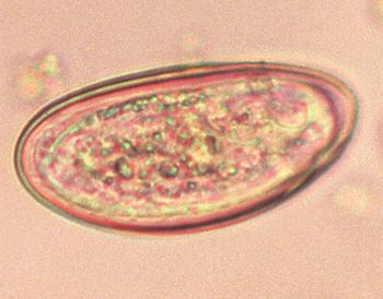 CDC_Pinworm_450.jpg