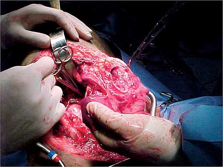 veterinary_crowe_case_3-615017-1384500578231.jpg