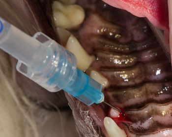 veterinary_Bellows_A-C_5b_450.jpg