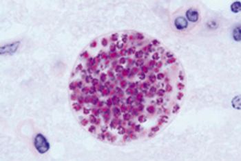 Veterinary_1280px-Toxoplasma_gondii_tissue_cyst_in_mouse_brain_220px.jpg