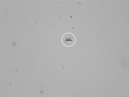white particles in urine