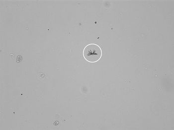 Veterinary-9-BillirubinCrystal.jpg