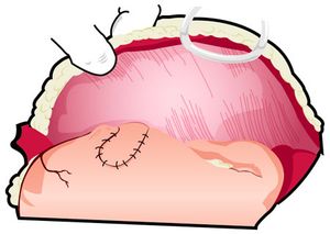Step6_Gastropexy_450-791743-1384155963490.jpg