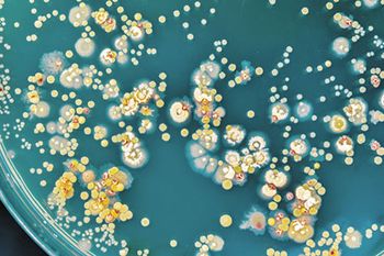 veterinary-bacterial-colony-450px-shutterstock-537846901.jpg